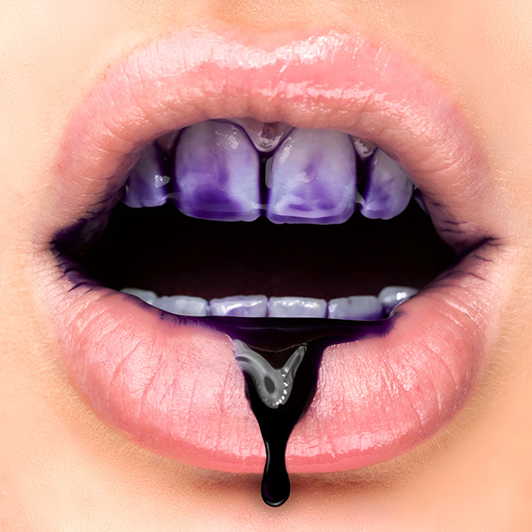 JOYTEETH